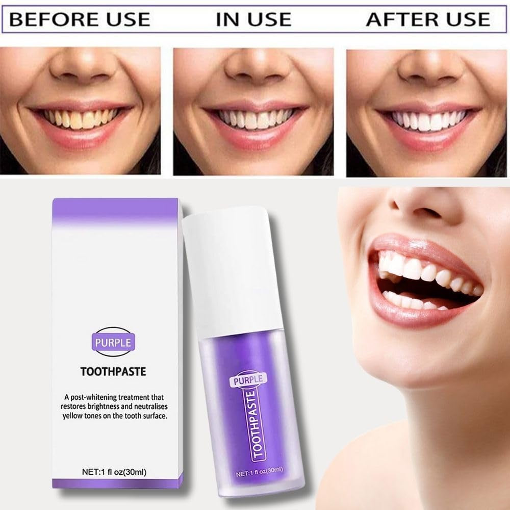 Purple Toothpaste for Teeth Whitening, Purple Teeth Whitening, Purple Teeth Whitening Foam, Tooth Stain Removal, Purple Toothpaste Teeth Whitener